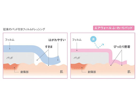 skinix エアウォールふ・わ・りパッド パッド付きフィルムドレッシング