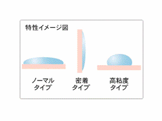 ジェクス 超音波検査用プロゼリー 300g【通販フォレストウェイ】